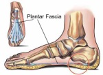 Site of pain in plantar fascia